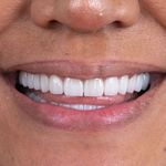 دندانپزشکی میلانا