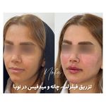 کلینیک زیبایی و لیزر مو زائد نوبا