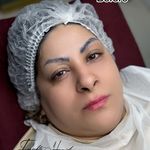 خدمات تخصصی آرایش دائم و ریموو فرشته حمیدی