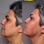 کلینیک زیبایی و مرکز لیزر هانیسا