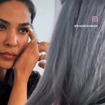 لیزر،پوست،مو(منطقه ۷ تهران)دکتر محمودی