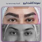 کلینیک کاشت مو دیبا