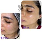 خدمات تخصصی فیشال سارا اسکین بار