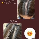 اسکراب اسکالپ تخصصی رستا