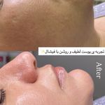 مرکز تخصصی فیشال و پاکسازی پوست حنانه
