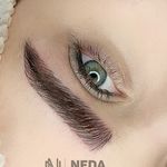 میکرو، شیدینگ لب ریموو تتو میکرواسکالپ ندا