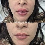 کلینیک لیزر و زیبایی دکتر لیلا حسینی