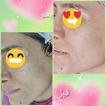 فیشال و پاکسازی پوست درنواب