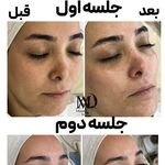 خدمات پوستی میراندا آواک