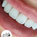 کلینیک دندان پزشکی و ایمپلنت الیسو