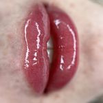 مركز تخصصي ناخن و فيبروز مِمُل