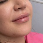 کلینیک زیبایی پوستینو