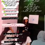 کاشت واکستنشن مژه کیانا