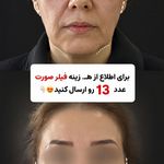 کلینیک زیبایی آرزو
