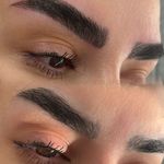 خدمات تخصصی فیبروز تینا درخشان