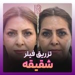 کلینیک زیبایی بیانکا