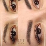 مرکز میکروبلیدینگ شیدینگ ریموو اسکالپ