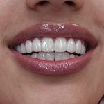 کلینیک‌دندانپزشکی دنتال آرنا-بیمه نیستیم