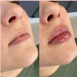 کلینیک پوست و زیبایی ژیلاوَش