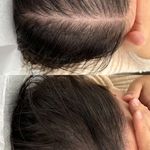 اجرای خدمات تتو صورت و بدن