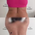 کلینیک تخصصی لاغری موضعی ولافیت