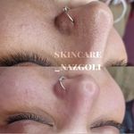 فیشال پوست نازگل