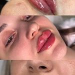 کلینیک پوست و زیبایی ژیلاوَش