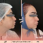 مرکز پزشکی و زیبایی میروژ سنتر