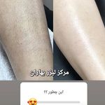مرکز لیزر و کلینیک زیبایی بهاران