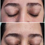 اصلاح تخصصی وترمیمی ابروی فرزانه