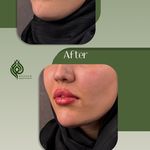 کلینیک پوست مو زیبایی حضور