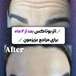 مرکز لیزر کلینیک زیبایی رزنیلای مرزداران