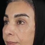 کلینیک زیبایی الماس کاملا اقساطی