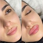 کلینیک پوست و زیبایی ژیلاوَش