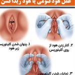 لابیوپلاستی و زیبایی زنان در غرب تهران