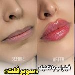 کلینیک زیبایی، پوست و مو نچرال بیوتی