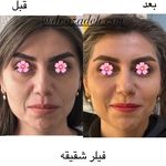 کلینیک زیبایی و لیزر دکتر آزاده اسماعیلی