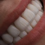 دندانپزشکی دکتر المیرا پویان فر