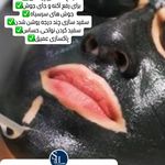 مطب پوست، مو و زیبایی و لیزر شبیرا