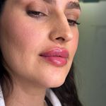 کلینیک زیبایی رامارز