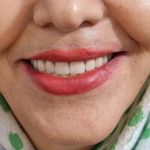 دندانسازی حسینی
