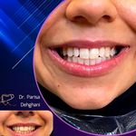 دندانپزشکی زیبایی دکتر پریسا دهقانی