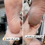 خدمات تخصصی  ناخن Sarniz