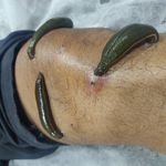 طب سنتی الف