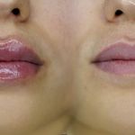کلینیک زیبایی الماس کاملا اقساطی