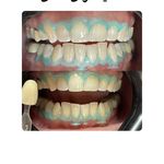 دندانپزشکی دکتر یحیی پور-بیمه داریم