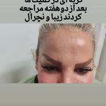 مرکز زیبایی بوتاکس و ژل و لیزر نایس
