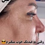 مرکز تخصصی فیشال و پاکسازی پوست تینا