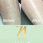 کلینیک پوست،مو و لیزر زینا مختاری