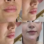 کلینیک زیبایی کاترین